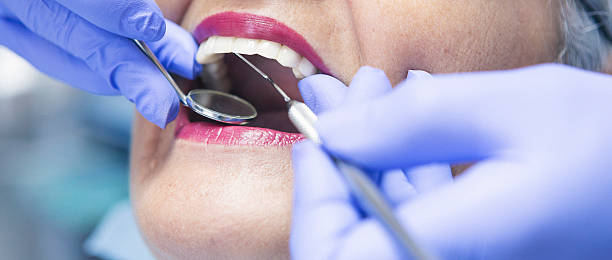 Best Emergency Gum Treatment in Loughman, FL